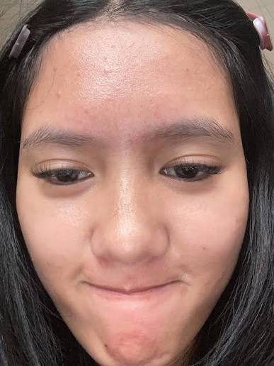Fungal Acne Safe (Malassezia-Safe) Skincare