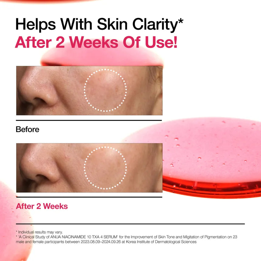 Anua Niacinamide 10 TXA 4 Serum (Girl Math Dealz)