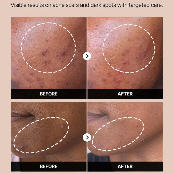 COSRX The Alpha-Arbutin 2 Discoloration Care Serum