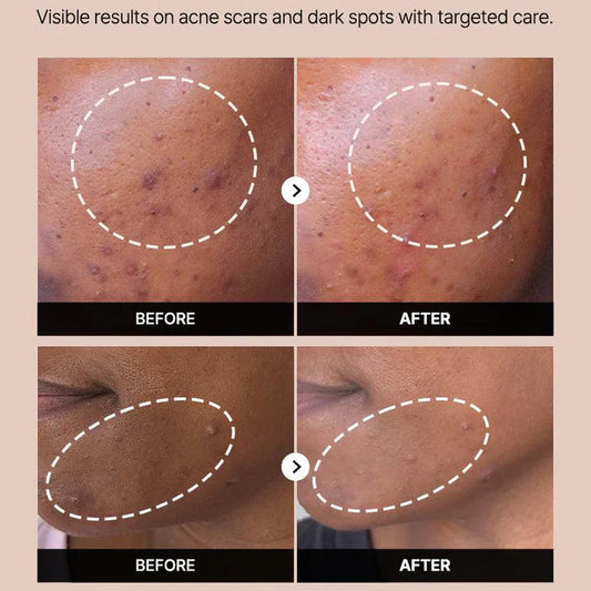 COSRX The Alpha-Arbutin 2 Discoloration Care Serum