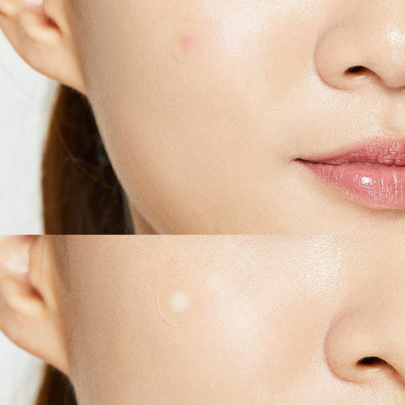 COSRX Acne Pimple Master Patch
