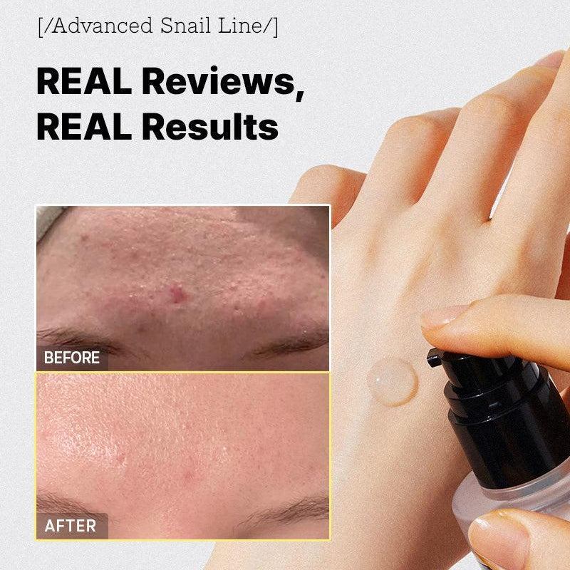 COSRX Advanced Snail 96 Mucin Power Essence