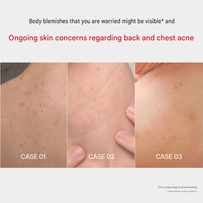 VT Reedle Shot Body Clear Acne Clear Body Wash