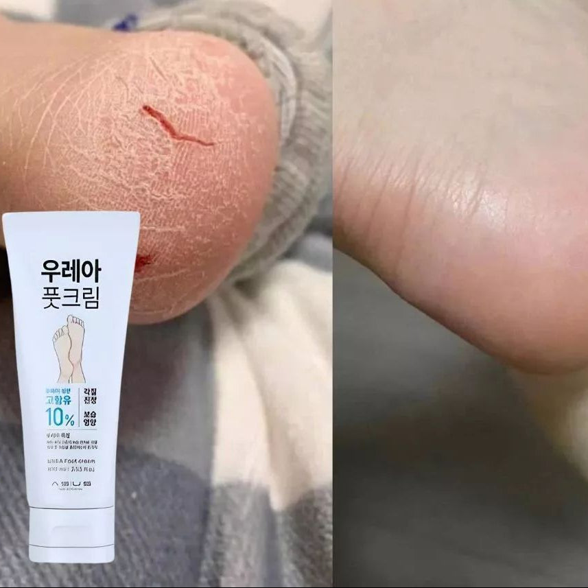 Daiso Urea Foot Cream
