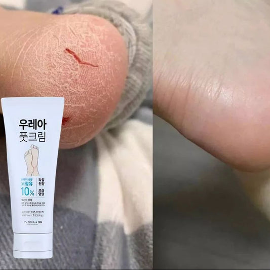 Daiso Urea Foot Cream